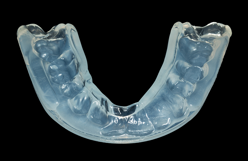 clear custom mouthguard from dentist